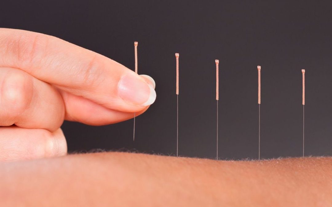 What is Acupuncture and How Does It Work? A Beginner’s Guide